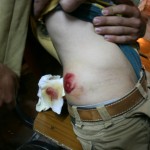 Abdalah Aadus shot with tear gas canister