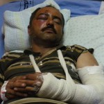 Akram Taysir Daoud sits half-conscious in his hospital bed