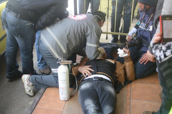 Journalist treated for teargas inhalation 