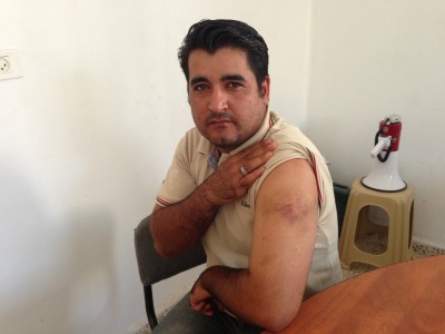 One of the workers shows his bruises after a settler attack (Photo by ISM)