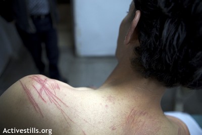 Palestinian Organizer Tortured in Israeli Jail.