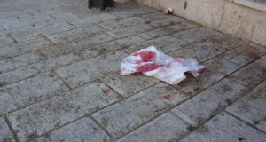 Bloody rags after a Palestinian boy was attacked by Israeli settlers