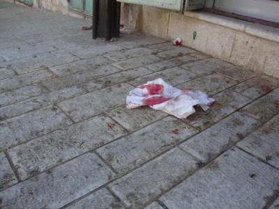 Bloody rags after a Palestinian boy was attacked by Israeli settlers
