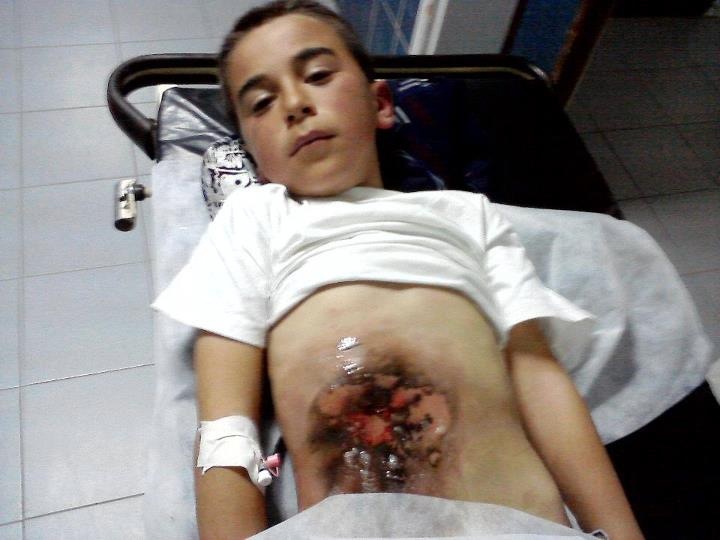 Qaryut: 8 year old injured by bomb planted by Israelis