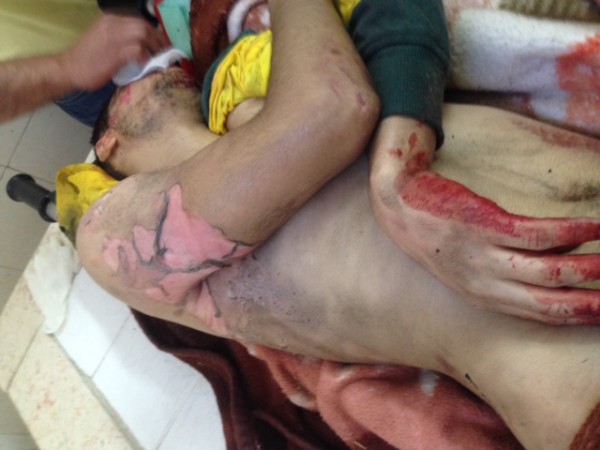 The battered body of Abdullah Eyad Ghanayem.