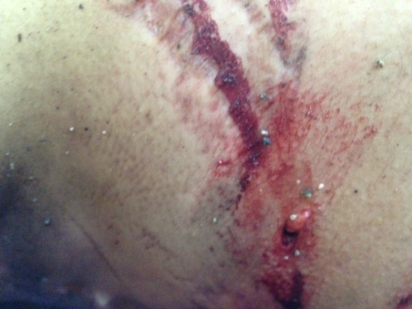 Wounds on Ghanayem's body