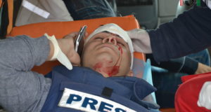 Palestinian journalist shot in the face by Israeli Forces with rubber coated steel bullets.