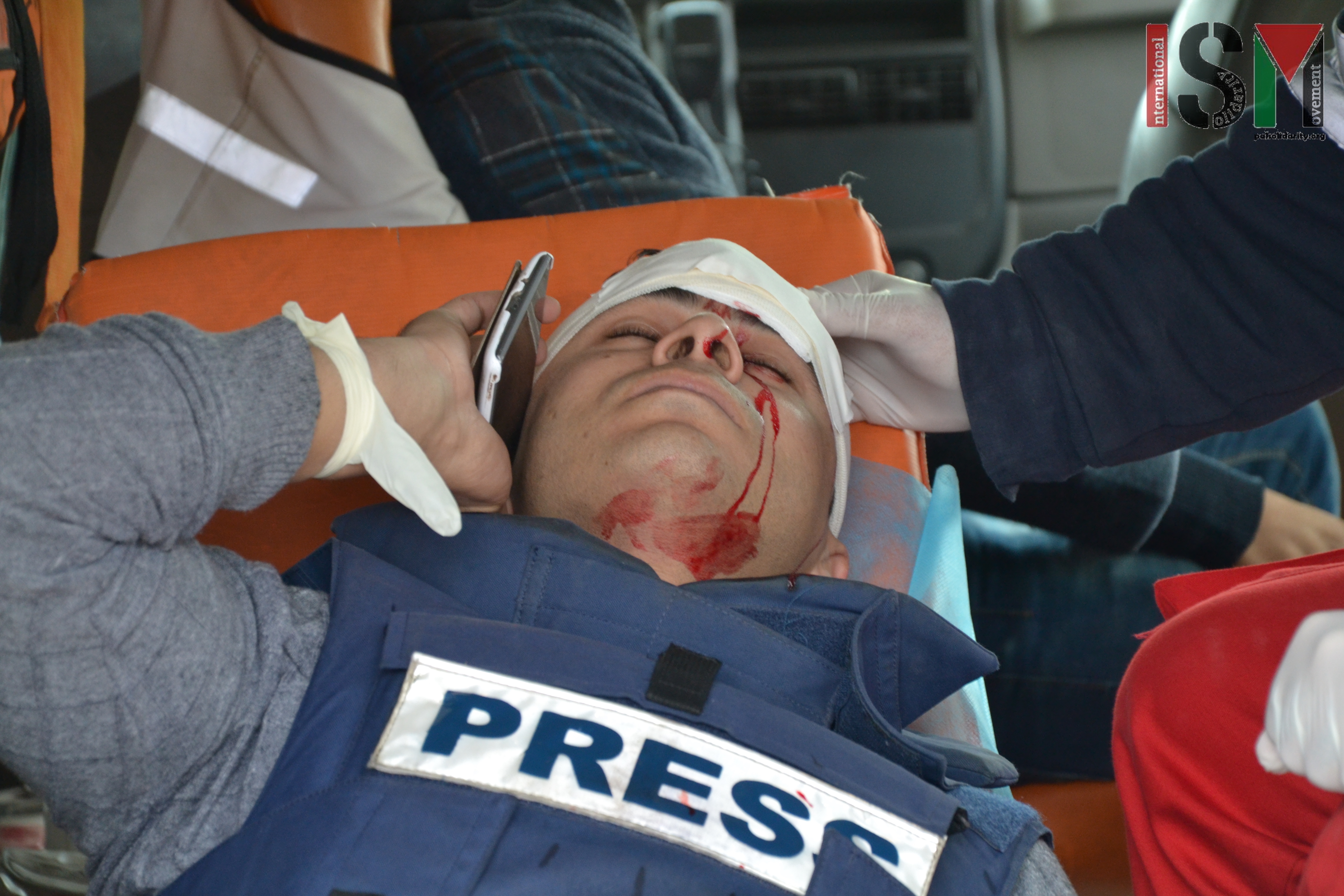 Palestinian journalist shot in the face by Israeli Forces with rubber coated steel bullets.