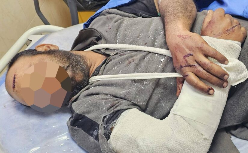 Two Palestinian shepherds hospitalized following brutal attack by Israeli settlers in Khirbet Hammamat al-Maleh al-Meetah