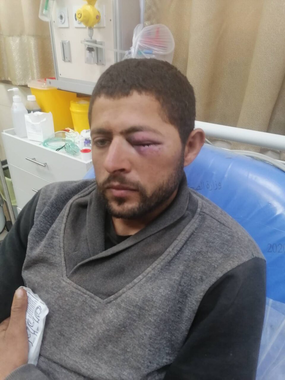 Photo: a Palestinian family member sits in the hospital with an eye swollen shut following a violent attack by 30 masked Israeli settlers on Palestinians and internationals